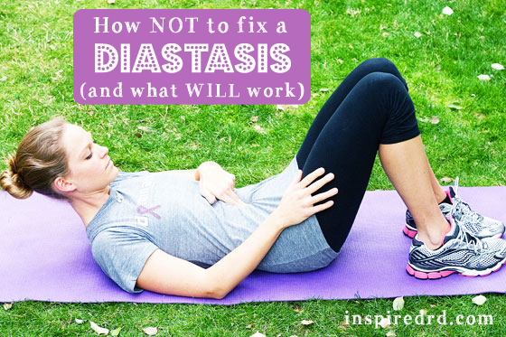 Diastasis Recti - How NOT to fix it (and what WILL work)