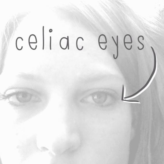 What I want you to know about celiac disease